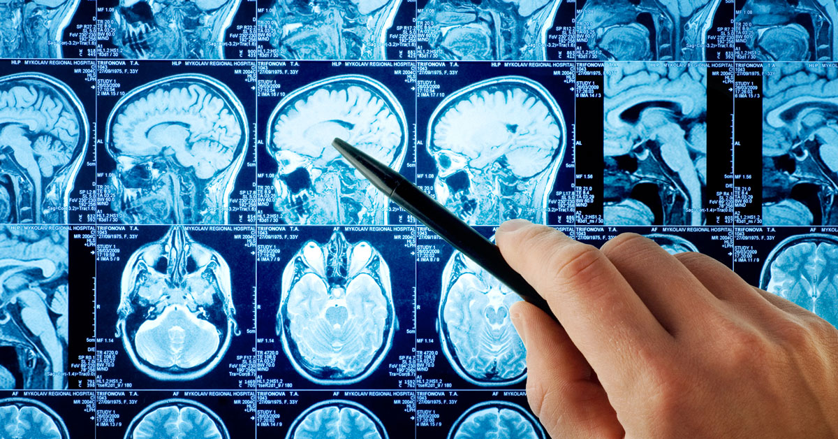 Cognitive Remediation and Reeducation