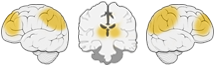 how towers of hanoi engages the brain.